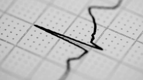 Tăng nhịp tim ở trẻ nhỏ được xem là tim đập nhanh