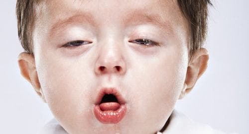 Bệnh hen suyễn là một trong những bệnh hô hấp phổ biến với những cơn co thắt phế quản, viêm hẹp đường dẫn khí gây khó thở cho người bệnh.