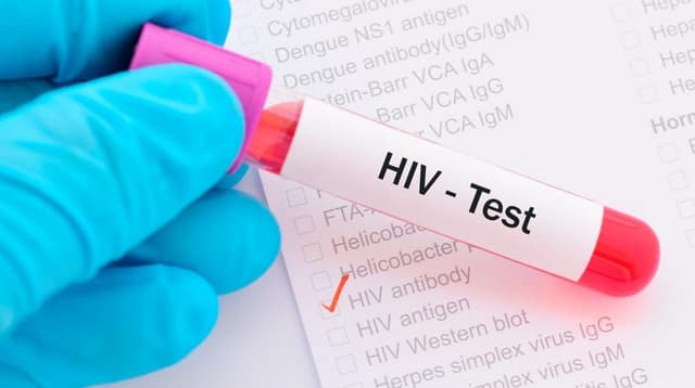 Xét nghiệm HIV ở đâu? có nguy cơ tử vong cao