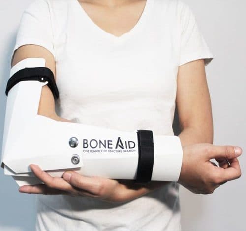 bi-gay-xuong-nen-an-gi