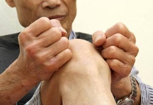 Bệnh phong thấp gây đau đớn hạn chế khả năng di chuyển cho người bệnh