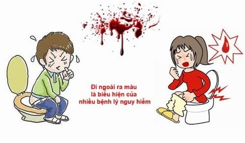 Đại tiện ra máu tươi cảnh báo bệnh lý nguy hiểm
