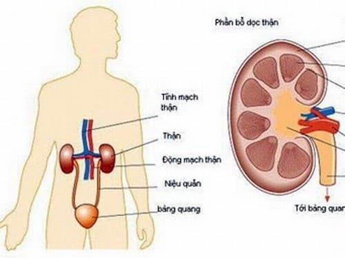 Biến chứng bệnh gout gây tổn thương thận