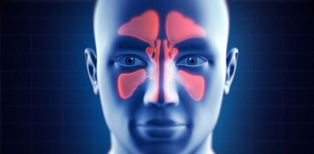 Viêm đa xoang mạn tính là gì, nhận biết và điều trị đúng cách