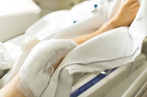  Phẫu thuật thay khớp gối nhân tạo được chỉ định cho các trường hợp sụn khớp gối bị tổn thương quá nặng mà các phương pháp điều trị nội khoa hay bảo tồn đều không mang đến hiệu quả. 