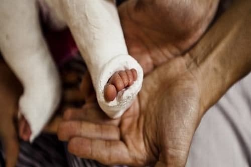 Ở trẻ em, thời gian hồi phục thường nhanh hơn 