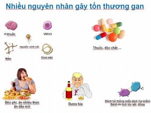 Có nhiều nguyên nhân khiến men gan cao