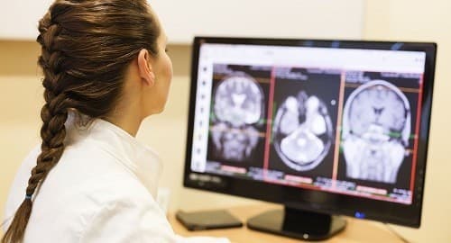 nguyên nhân gây đau đầu 