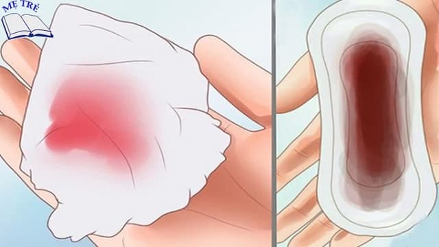 Máu kinh nguyệt và máu có thai khác nhau thế nào?