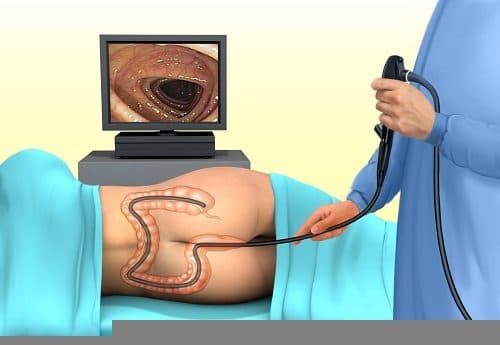 Sau mổ nội soi đại tràng nên ăn gì là thắc mắc chung được nhiều người đưa ra