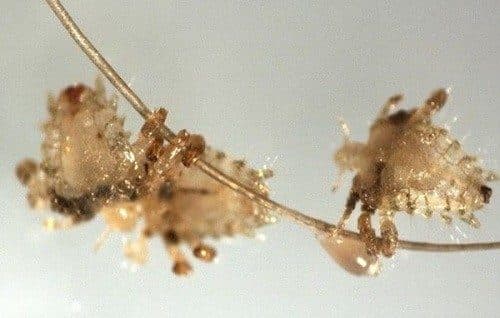 Trị rận mu bằng dầu hỏa