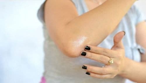 Các Xử Lý Bong Gân Khuỷu Tay 