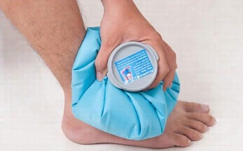 Bong gân nên chườm lạnh