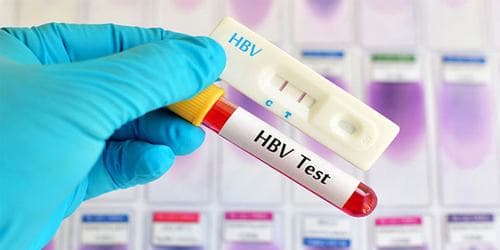 Chỉ số HBsAg bao nhiêu là bình thường