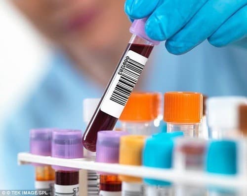 Xét nghiệm GGT giúp chẩn đoán phát hiện tổn thương gan