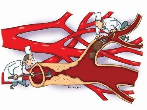 Chỉ số triglyceride là gì? rối loạn mỡ máu