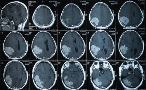 【BÁO GIÁ】Chụp CT giá bao nhiêu và CHỈ ĐỊNH chụp CT khi nào? 3