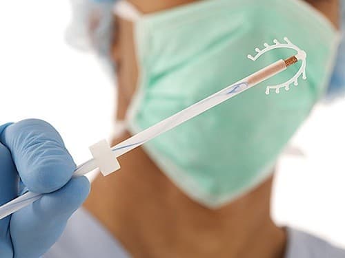 Đặt vòng tránh thai là một tiểu phẫu được tiến hành nhanh chóng, dễ dàng và hiệu quả