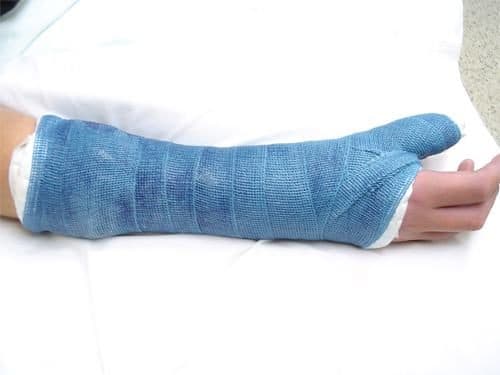 Trong quá trình hồi phục, người bệnh nên nghỉ ngơi và giảm các hoạt động mạnh bên tay bị gãy