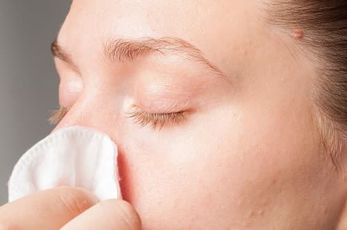 nguyên nhân chảy máu cam 