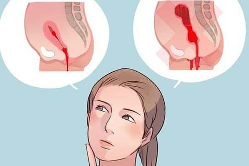 Tùy theo cơ địa mỗi người, sản dịch sau sinh kéo dài khác nhau