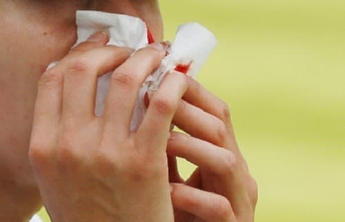 Khi thấy xuất hiện các triệu chứng nghi ngờ mắc ung thư vòm họng cần đi khám càng sớm càng tốt