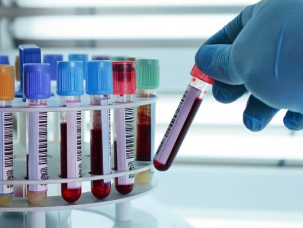 Xét nghiệm gan cần chú ý những gì?