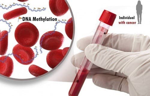 Xét nghiệm máu thường kết hợp với các xét nghiệm khác nhằm chẩn đoán sớm ung thư
