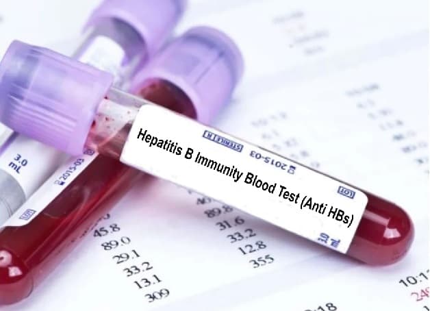 Tìm hiểu Anti HBs là gì?