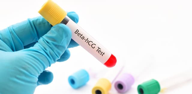 Lý giải nguyên nhân dẫn đến nồng độ beta hCG thấp