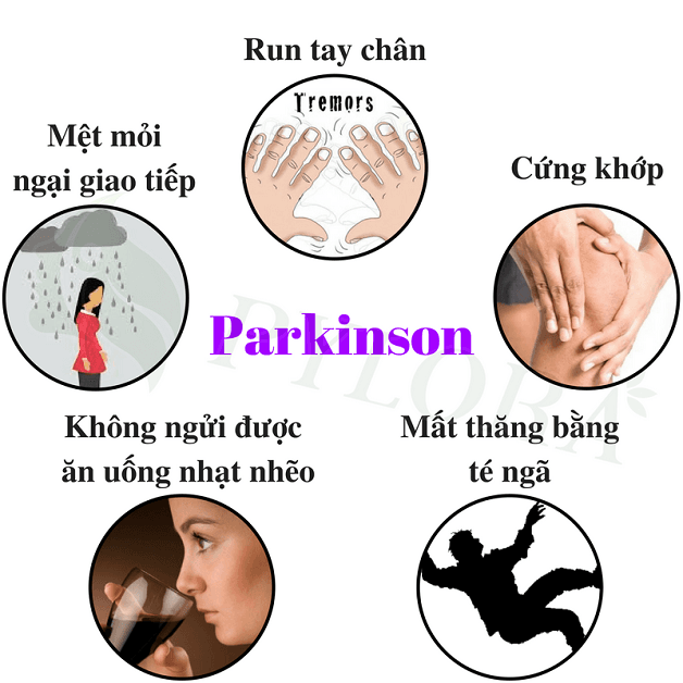 Dấu hiệu nhận biết hội chứng parkinson