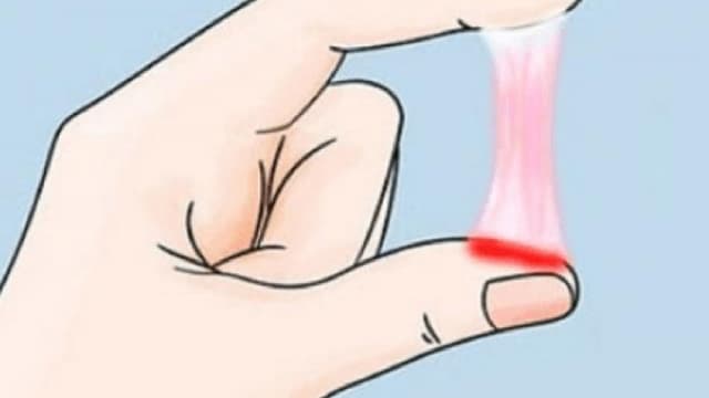 Ra nhiều khí hư màu trắng trong là bị gì?