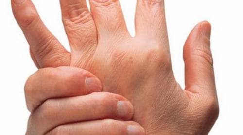 lớn người bệnh Still gặp phải triệu chứng đau khớp