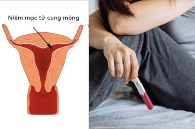 Niêm mạc tử cung dày hay mỏng đều có những ảnh hưởng nhất định tới khả năng thụ thai ở chị em phụ nữ