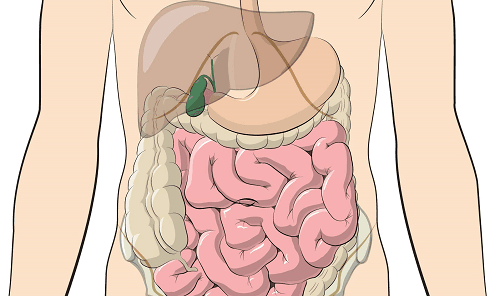 phẫu thuật viêm phúc mạc 