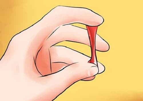 Ra máu khi quan hệ là hiện tượng nhiều chị em từng gặp phải