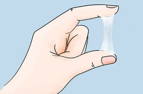 Ra nhiều khí hư màu trắng đục là hiện tượng khiến nhiều chị em lo lắng