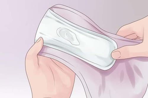 Ra nhiều khí hư màu trắng đục là sao?