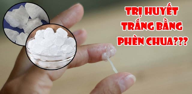 Trị huyết trắng bằng phèn chua: Có nên hay không?