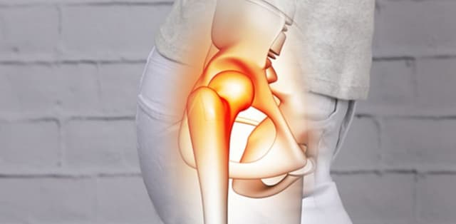 Nguyên nhân gây viêm khớp háng ở người lớn