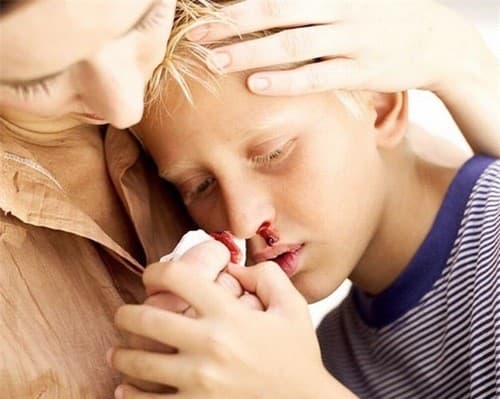 Nổi hạch và chảy máu cam, sốt, mệt mỏi... là những triệu chứng cảnh báo bệnh ung thư máu