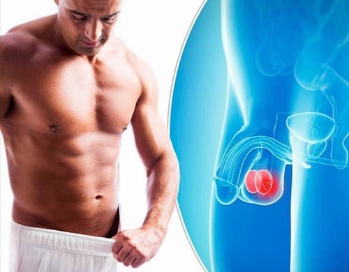Xét nghiệm ung thư tinh hoàn phổ biến ở nam giới