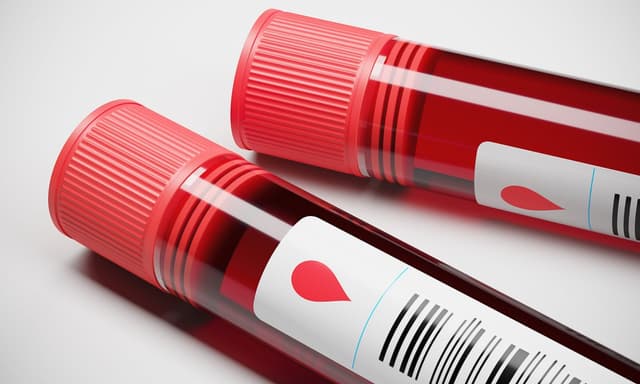 Xét nghiệm ung thư vú bao nhiêu tiền?