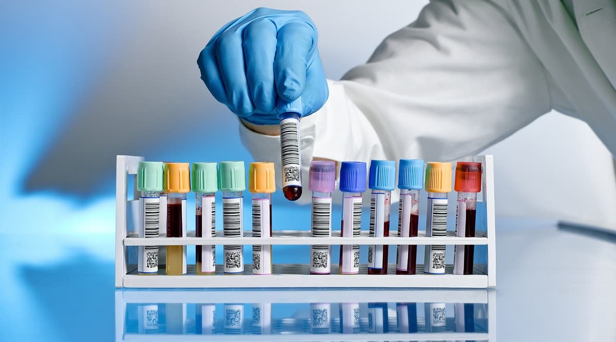 Ý nghĩa các chỉ số và chi phí xét nghiệm chức năng thận