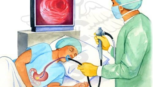 Hình ảnh nội soi dạ dày đường miệng