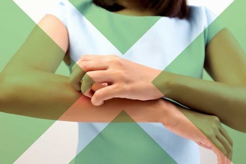 Người bị ngứa phát trên da không được gãi để ngừa tổn thương da 