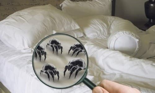 Ngứa toàn thân có thể do dị ứng với chăn đệm