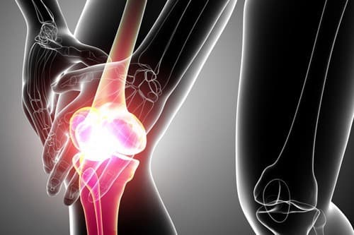 Ung thư xương có di truyền không?