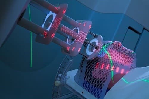 Hóa trị và xạ trị khác nhau như thế nào