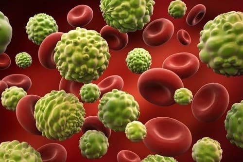 Xạ trị chủ yếu được sử dụng khi ung thư đã xâm chiếm một hoặc nhiều khu vực trên cơ thể.